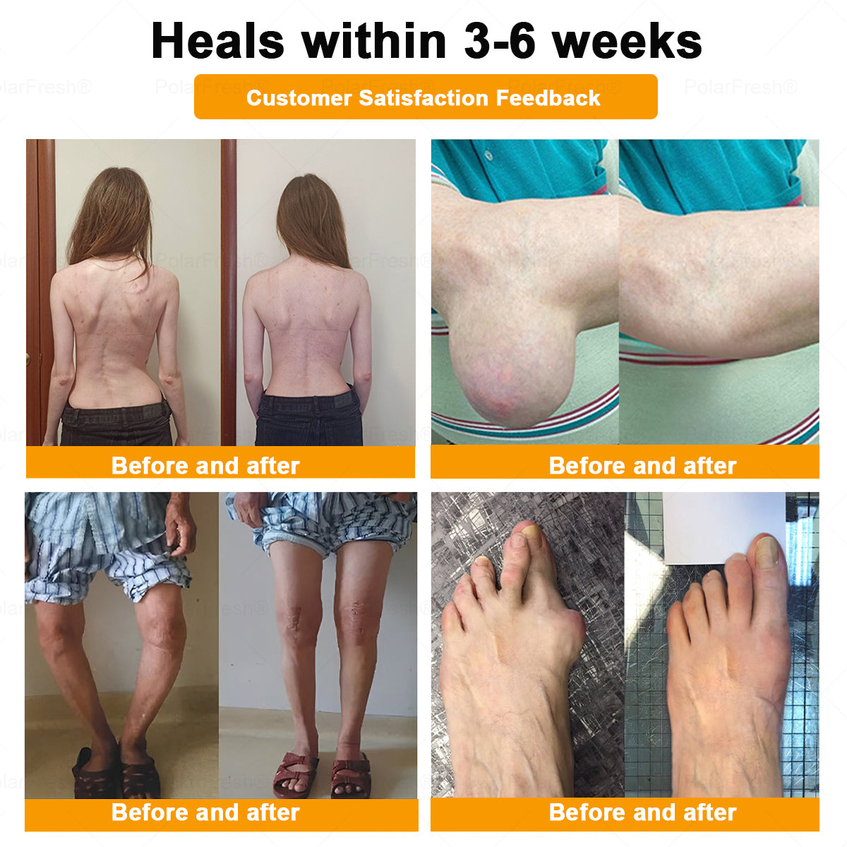 𝐂𝐚𝐫𝐞𝐔𝐩𝐥𝐢𝐟𝐭® 𝐌𝐮𝐥𝐭𝐢-𝐄𝐟𝐟𝐞𝐜𝐭 𝐏𝐚𝐢𝐧 𝐑𝐞𝐥𝐢𝐞𝐟 𝐚𝐧𝐝 𝐑𝐞𝐩𝐚𝐢𝐫 𝐂𝐫𝐞𝐚𝐦 𝐜𝐨𝐧𝐭𝐚𝐢𝐧𝐬 𝐛𝐨𝐭𝐮𝐥𝐢𝐧𝐮𝐦 𝐭𝐨𝐱𝐢𝐧 (𝐚𝐥𝐨𝐧𝐠 𝐰𝐢𝐭𝐡 𝐦𝐚𝐠𝐧𝐞𝐬𝐢𝐮𝐦, 𝐛𝐞𝐞 𝐯𝐞𝐧𝐨𝐦, 𝐚𝐧𝐝 𝐛𝐨𝐭𝐮𝐥𝐢𝐧𝐮𝐦 𝐭𝐨𝐱𝐢𝐧-𝐥𝐢𝐤𝐞 𝐩𝐞𝐩𝐭𝐢𝐝𝐞𝐬).
