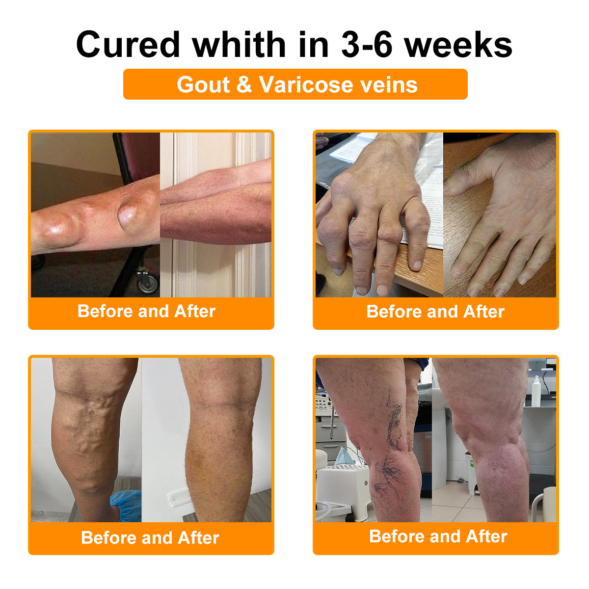 𝐂𝐚𝐫𝐞𝐔𝐩𝐥𝐢𝐟𝐭® 𝐌𝐮𝐥𝐭𝐢-𝐄𝐟𝐟𝐞𝐜𝐭 𝐏𝐚𝐢𝐧 𝐑𝐞𝐥𝐢𝐞𝐟 𝐚𝐧𝐝 𝐑𝐞𝐩𝐚𝐢𝐫 𝐂𝐫𝐞𝐚𝐦 𝐜𝐨𝐧𝐭𝐚𝐢𝐧𝐬 𝐛𝐨𝐭𝐮𝐥𝐢𝐧𝐮𝐦 𝐭𝐨𝐱𝐢𝐧 (𝐚𝐥𝐨𝐧𝐠 𝐰𝐢𝐭𝐡 𝐦𝐚𝐠𝐧𝐞𝐬𝐢𝐮𝐦, 𝐛𝐞𝐞 𝐯𝐞𝐧𝐨𝐦, 𝐚𝐧𝐝 𝐛𝐨𝐭𝐮𝐥𝐢𝐧𝐮𝐦 𝐭𝐨𝐱𝐢𝐧-𝐥𝐢𝐤𝐞 𝐩𝐞𝐩𝐭𝐢𝐝𝐞𝐬).