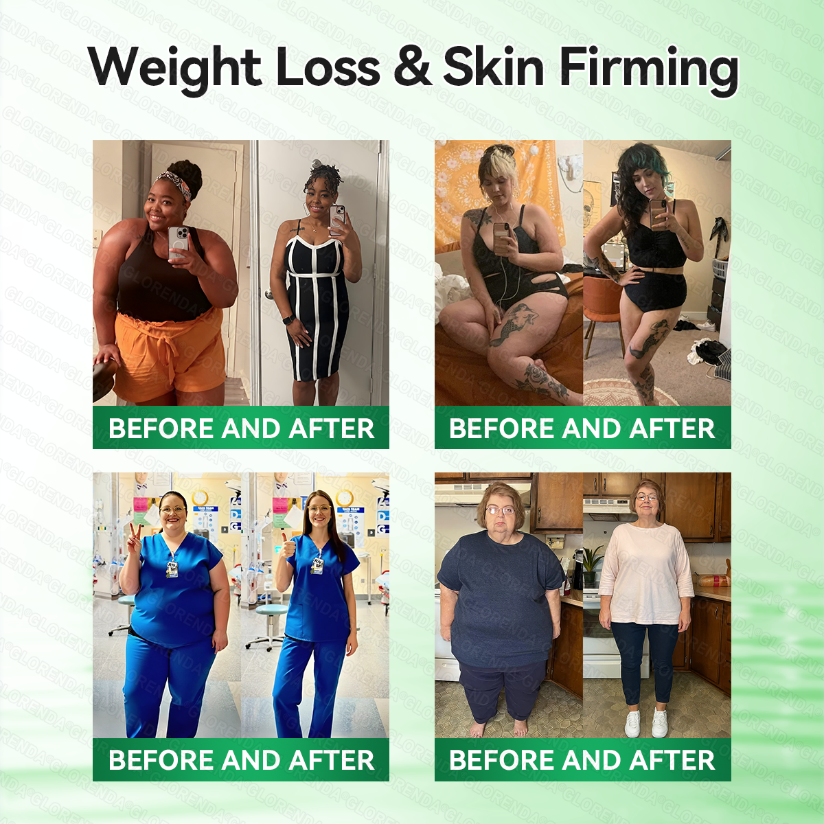 𝑶𝒇𝒇𝒊𝒄𝒊𝒂𝒍 𝑺𝒕𝒐𝒓𝒆  | 💯𝐂𝐚𝐫𝐞𝐔𝐩𝐥𝐢𝐟𝐭®𝑴𝒐𝒓𝒊𝒏𝒈𝗮 · 𝗕𝗲𝗿𝗯𝗲𝗿𝙞𝙣𝙚 × 𝙉𝘼𝐃+ 𝟏𝟎-𝐢𝐧-𝟏 𝗔𝗱𝘃𝗮𝗻𝗰𝙚𝙙 𝙉𝙖𝙣𝙤 𝙈𝙞𝙘𝙧𝙤𝙣𝙚𝙚𝐝𝐥𝐞 𝐏𝐚𝐭𝙘𝙝🇺🇸(𝐉𝐮𝐬𝐭 𝐨𝐧𝐜𝐞 𝐚 𝐝𝐚𝐲, 𝐯𝐢𝐬𝐢𝐛𝐥𝐞 𝐜𝐡𝐚𝐧𝐠𝐞𝐬 𝐢𝐧 𝟕 𝐝𝐚𝐲𝐬） ✅ 𝐅𝐨𝐫 𝐨𝐛𝐞𝐬𝐢𝐭𝐲, 🅛🅞🅞🅢🅔 🅢🅚🅘🅝,𝐝𝐢𝐚𝐛𝐞𝐭𝐞𝐬, 𝐬𝐥𝐞𝐞𝐩 𝐚𝐩𝐧𝐞𝐚, 𝐣𝐨𝐢𝐧𝐭 𝐢𝐬𝐬𝐮𝐞𝐬, 𝐚𝐧𝐝 𝐦𝐨𝐫𝐞💯