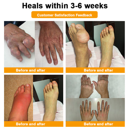 𝐂𝐚𝐫𝐞𝐔𝐩𝐥𝐢𝐟𝐭® 𝐌𝐮𝐥𝐭𝐢-𝐄𝐟𝐟𝐞𝐜𝐭 𝐏𝐚𝐢𝐧 𝐑𝐞𝐥𝐢𝐞𝐟 𝐚𝐧𝐝 𝐑𝐞𝐩𝐚𝐢𝐫 𝐂𝐫𝐞𝐚𝐦 𝐜𝐨𝐧𝐭𝐚𝐢𝐧𝐬 𝐛𝐨𝐭𝐮𝐥𝐢𝐧𝐮𝐦 𝐭𝐨𝐱𝐢𝐧 (𝐚𝐥𝐨𝐧𝐠 𝐰𝐢𝐭𝐡 𝐦𝐚𝐠𝐧𝐞𝐬𝐢𝐮𝐦, 𝐛𝐞𝐞 𝐯𝐞𝐧𝐨𝐦, 𝐚𝐧𝐝 𝐛𝐨𝐭𝐮𝐥𝐢𝐧𝐮𝐦 𝐭𝐨𝐱𝐢𝐧-𝐥𝐢𝐤𝐞 𝐩𝐞𝐩𝐭𝐢𝐝𝐞𝐬).