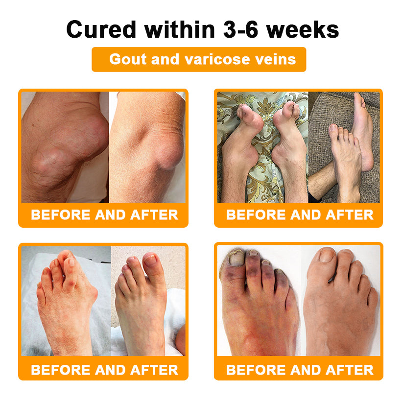 𝐂𝐚𝐫𝐞𝐔𝐩𝐥𝐢𝐟𝐭® 𝐌𝐮𝐥𝐭𝐢-𝐄𝐟𝐟𝐞𝐜𝐭 𝐏𝐚𝐢𝐧 𝐑𝐞𝐥𝐢𝐞𝐟 𝐚𝐧𝐝 𝐑𝐞𝐩𝐚𝐢𝐫 𝐂𝐫𝐞𝐚𝐦 𝐜𝐨𝐧𝐭𝐚𝐢𝐧𝐬 𝐛𝐨𝐭𝐮𝐥𝐢𝐧𝐮𝐦 𝐭𝐨𝐱𝐢𝐧 (𝐚𝐥𝐨𝐧𝐠 𝐰𝐢𝐭𝐡 𝐦𝐚𝐠𝐧𝐞𝐬𝐢𝐮𝐦, 𝐛𝐞𝐞 𝐯𝐞𝐧𝐨𝐦, 𝐚𝐧𝐝 𝐛𝐨𝐭𝐮𝐥𝐢𝐧𝐮𝐦 𝐭𝐨𝐱𝐢𝐧-𝐥𝐢𝐤𝐞 𝐩𝐞𝐩𝐭𝐢𝐝𝐞𝐬).