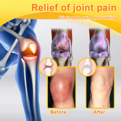 𝐂𝐚𝐫𝐞𝐔𝐩𝐥𝐢𝐟𝐭® 𝐌𝐮𝐥𝐭𝐢-𝐄𝐟𝐟𝐞𝐜𝐭 𝐏𝐚𝐢𝐧 𝐑𝐞𝐥𝐢𝐞𝐟 𝐚𝐧𝐝 𝐑𝐞𝐩𝐚𝐢𝐫 𝐂𝐫𝐞𝐚𝐦 𝐜𝐨𝐧𝐭𝐚𝐢𝐧𝐬 𝐛𝐨𝐭𝐮𝐥𝐢𝐧𝐮𝐦 𝐭𝐨𝐱𝐢𝐧 (𝐚𝐥𝐨𝐧𝐠 𝐰𝐢𝐭𝐡 𝐦𝐚𝐠𝐧𝐞𝐬𝐢𝐮𝐦, 𝐛𝐞𝐞 𝐯𝐞𝐧𝐨𝐦, 𝐚𝐧𝐝 𝐛𝐨𝐭𝐮𝐥𝐢𝐧𝐮𝐦 𝐭𝐨𝐱𝐢𝐧-𝐥𝐢𝐤𝐞 𝐩𝐞𝐩𝐭𝐢𝐝𝐞𝐬).