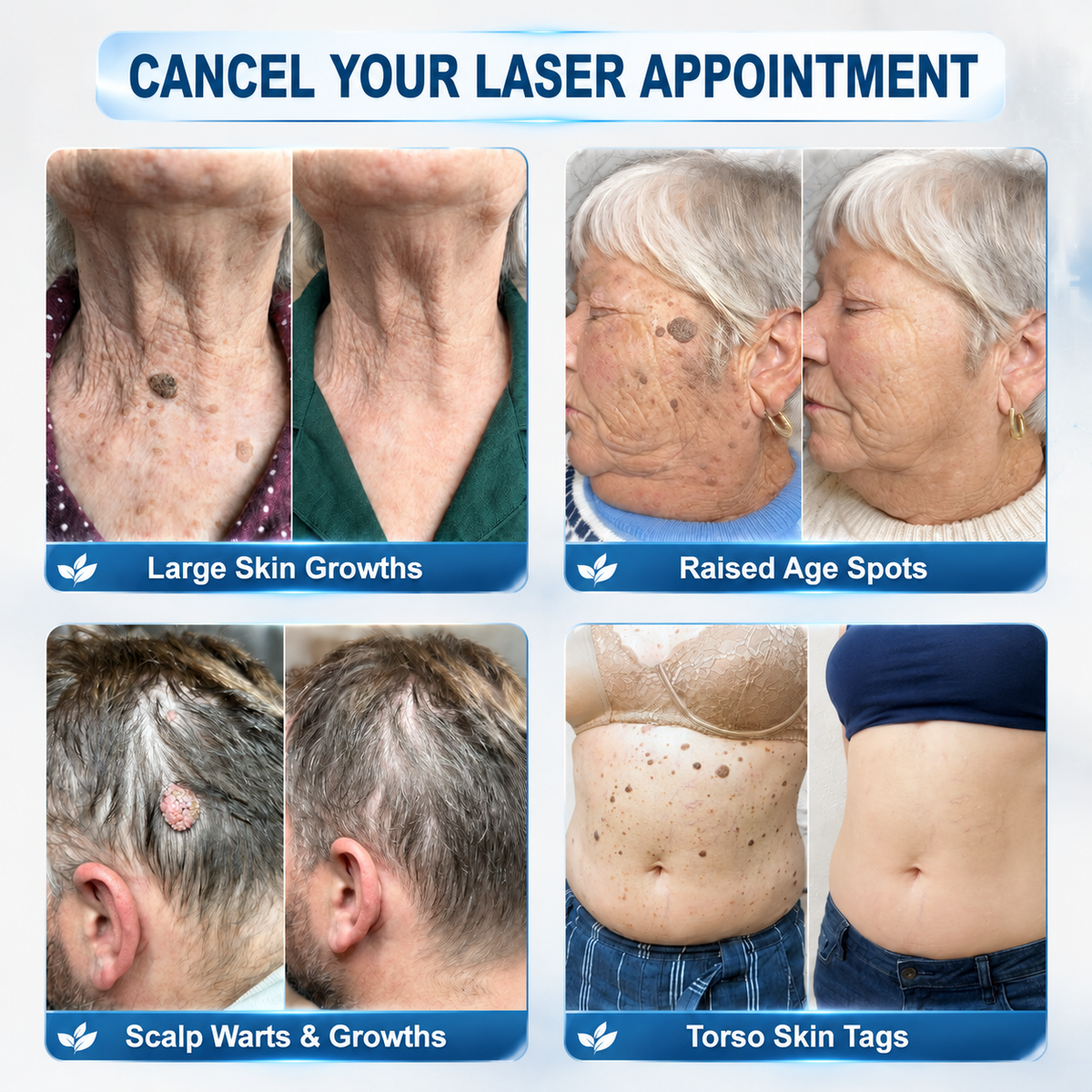 𝐎𝐟𝐟𝐢𝐜𝐢𝐚𝐥 𝐁𝐫𝐚𝐧𝐝 𝐒𝐭𝐨𝐫𝐞 |✅💎𝑯𝒊𝒔𝒌𝒊𝒏® 7-𝐷𝑎𝑦 𝗧𝐚𝐠 & 𝗦𝗽𝐨𝐭 𝐄𝐫𝒂𝒔𝒆𝒓(Zero Pain, Zero 𝐒𝐜𝐚𝒓𝒔 Rollerball)